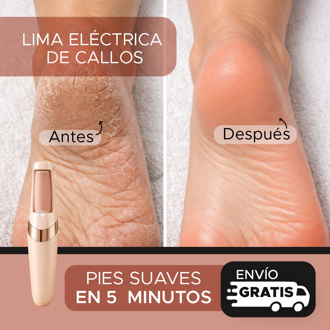 PODELLE™ Elimina Callos y Talones Agrietados