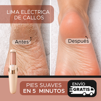 PODELLE™ Elimina Callos y Talones Agrietados